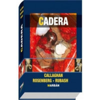 Cadera - Guanxe Atlantic Marketplace