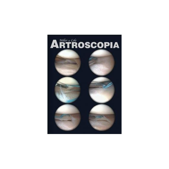 Artroscopia Flexilibro - Guanxe Atlantic Marketplace