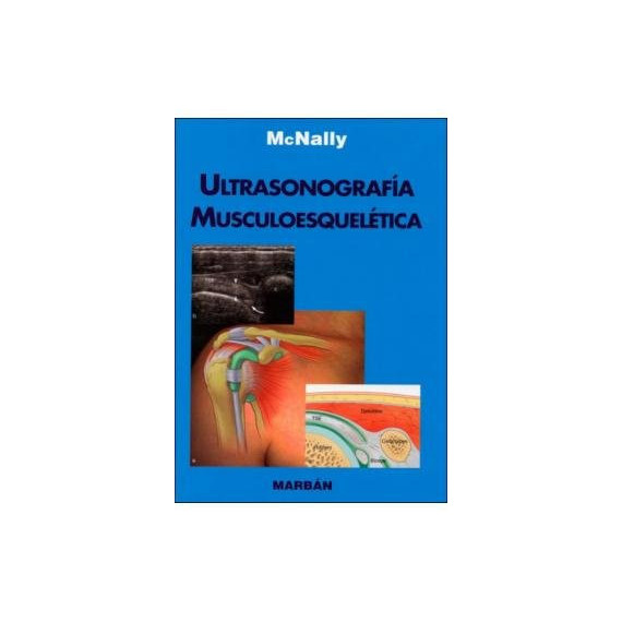 Ultrasonografia Musculoesqueletica