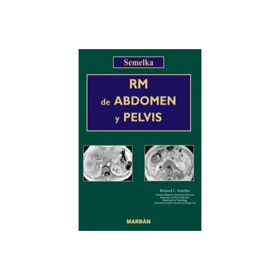Rm de Abdomen y Pelvis 2VOLS.