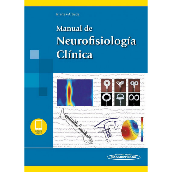 Iriarte:manual Neurofisiologãa Clãnica+e