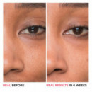 Bye Bye Pores Glycolic Acid Serum  IT COSMETICS