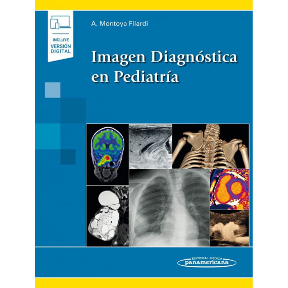 Imagen Diagnã³stica en Pediatrã­a (incluye Versiã³n Digital)