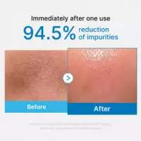 Zero Pore Blackhead Deep Cleansing Oil
aceite Limpiador Facial  MEDICUBE